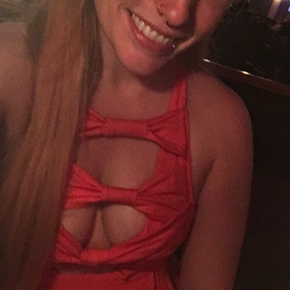 Nasty Gal 3 Bow Open Front/back Skater Dress - Picture 9 of 9